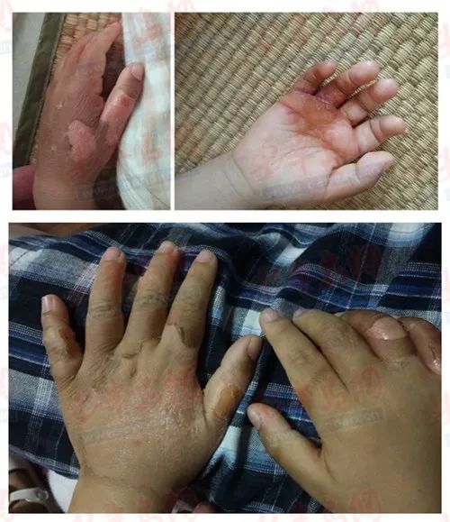 uһ׃@Hpև͑Ƥ׃@wԭ